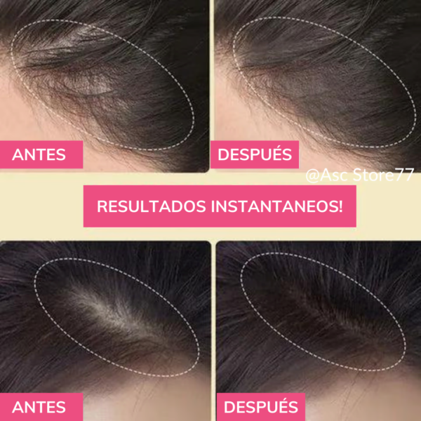 BUNEE HAIRLINE OPTIMIZER - Image 5